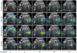 Towards Capturing Sonographic Experience: Cognition-Inspired Ultrasound Video Saliency Prediction